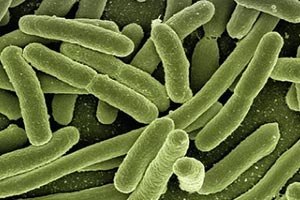 E. coli Expression System of protein