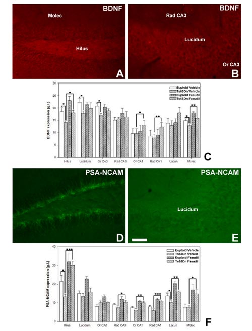 Changes in neuroplastic molecules expression in the hippocampus after chronic treatment with fasudil