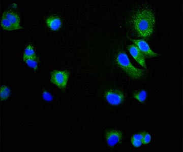 Antibodies, Protein, ELISA Kits, Clone And Reagents For Life Science ...