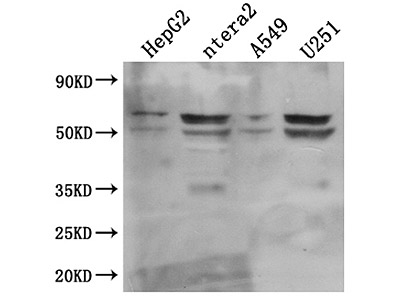 Antibodies, Protein, ELISA Kits, Clone And Reagents For Life Science ...