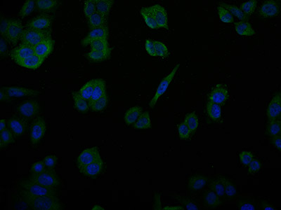 Antibodies, Protein, ELISA Kits, Clone And Reagents For Life Science ...