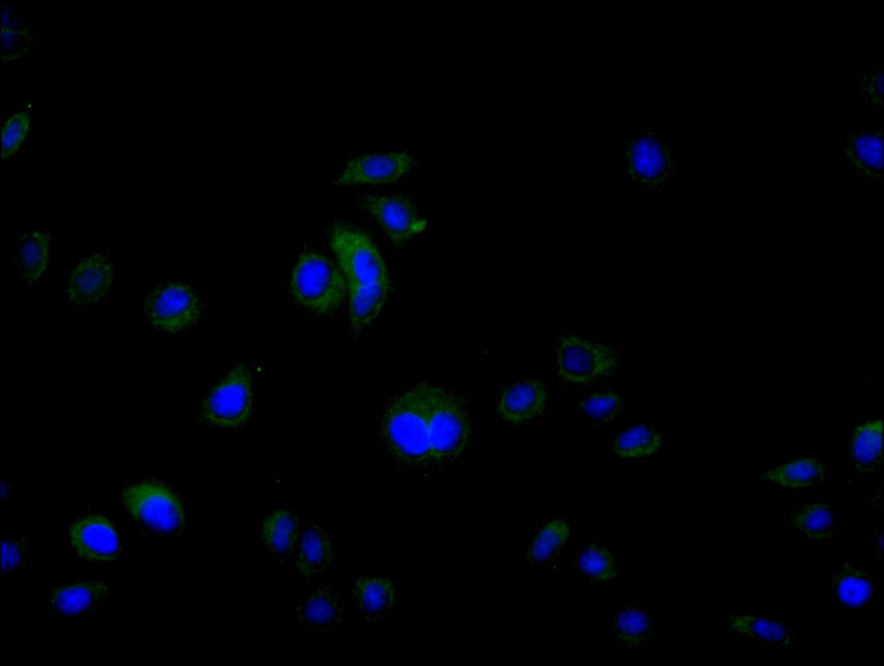 Immunofluorescence staining of Hela cell with CSB-PA006586LA01HU at 1:30, counter-stained with DAPI. The cells were fixed in 4% formaldehyde and blocked in 10% normal Goat Serum. The cells were then incubated with the antibody overnight at 4C. The secondary antibody was Alexa Fluor 488-congugated AffiniPure Goat Anti-Rabbit IgG(H+L).