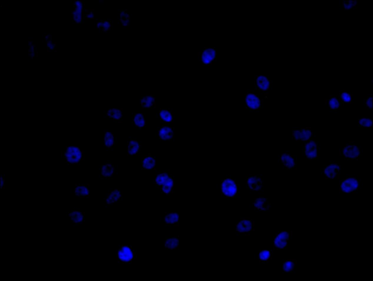 Immunofluorescence staining of Hela cell with 5% goat serum, counter-stained with DAPI. The cells were fixed in 4% formaldehyde and blocked in 10% normal Goat Serum. The cells were then incubated with the antibody overnight at 4C. The secondary antibody was Alexa Fluor 488-congugated AffiniPure Goat Anti-Rabbit IgG(H+L).