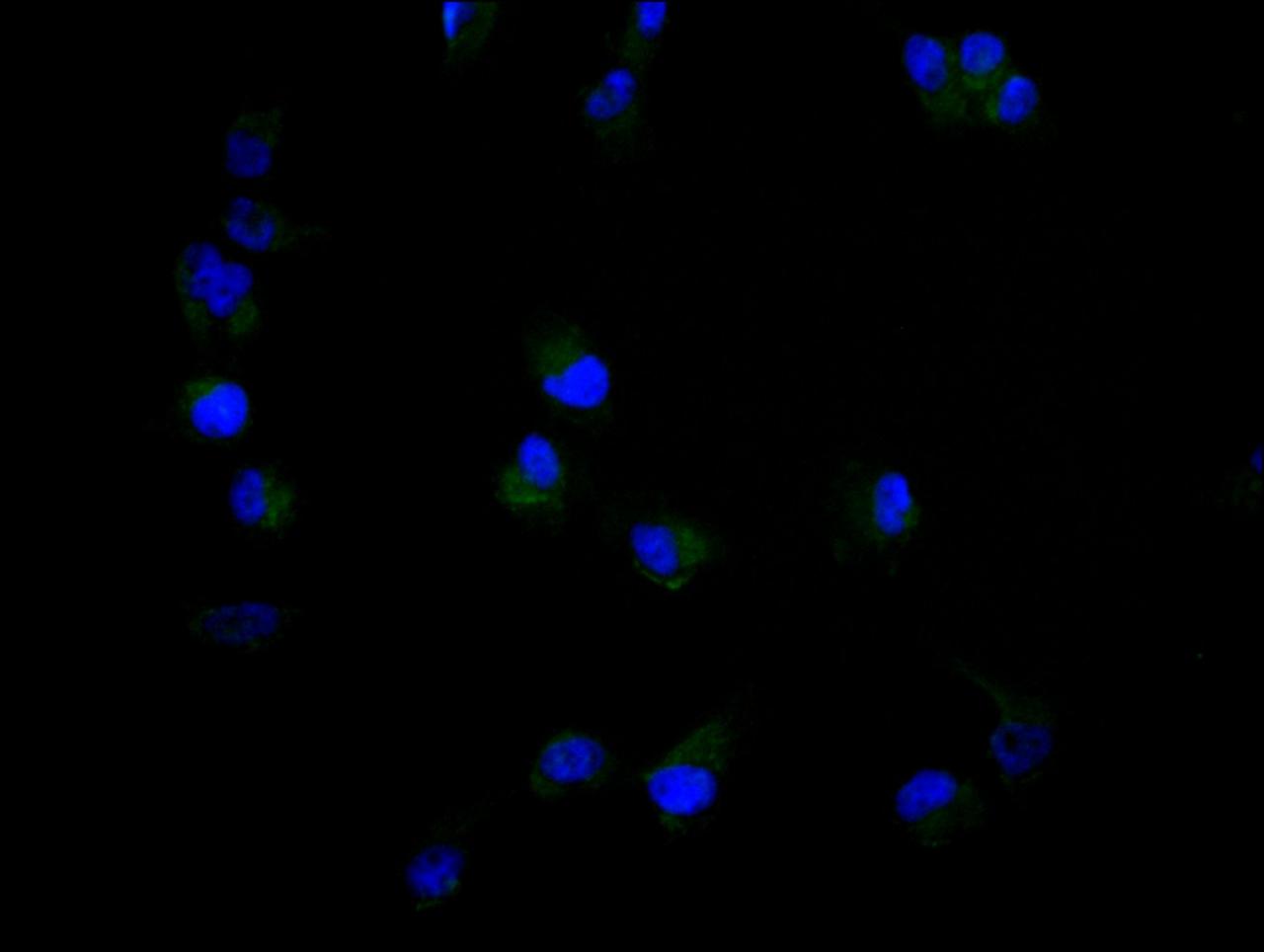 Immunofluorescence staining of U251 cell with CSB-PA006586LA01HU at 1:30, counter-stained with DAPI. The cells were fixed in 4% formaldehyde and blocked in 10% normal Goat Serum. The cells were then incubated with the antibody overnight at 4C. The secondary antibody was Alexa Fluor 488-congugated AffiniPure Goat Anti-Rabbit IgG(H+L).