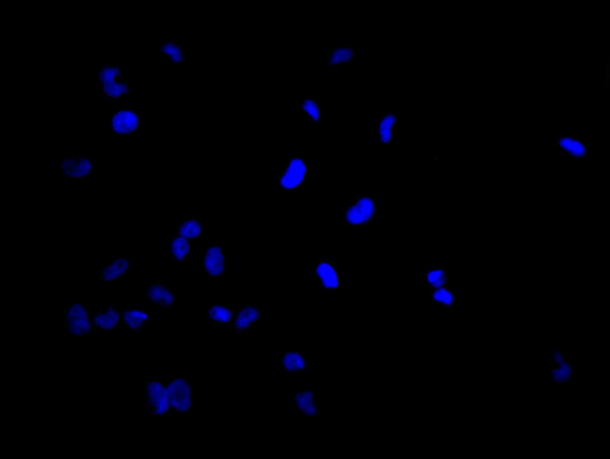 Immunofluorescence staining of U251 cell with 5% goat serum, counter-stained with DAPI. The cells were fixed in 4% formaldehyde and blocked in 10% normal Goat Serum. The cells were then incubated with the antibody overnight at 4C. The secondary antibody was Alexa Fluor 488-congugated AffiniPure Goat Anti-Rabbit IgG(H+L).