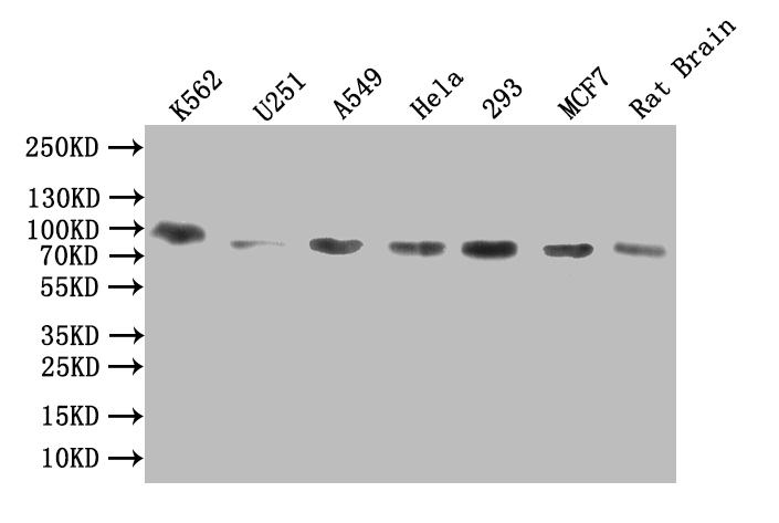 Western Blot Positive WB detected in: K562 whole cell lysate, U251 whole cell lysate, A549 whole cell lysate, Hela whole cell lysate, 293 whole cell lysate, MCF7 whole cell lysate, Rat Brain tissue lysate All lanes: DDHD2 antibody at 1:1000 Secondary Goat polyclonal to rabbit IgG at 1/50000 dilution Predicted band size: 82 kDa Observed band size: 82 kDa