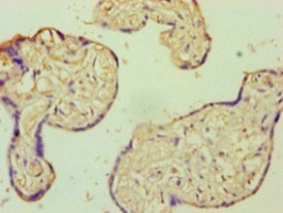 Immunohistochemistry of paraffin-embedded human placenta tissue using CSB-PA00667A0Rb at dilution of 1:100