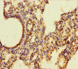 Immunohistochemistry of paraffin-embedded human lung tissue using CSB-PA00667A0Rb at dilution of 1:100