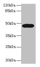 Western blot All lanes: LIPA antibody at 10microg/ml + A431 whole cell lysate Secondary Goat polyclonal to rabbit IgG at 1/10000 dilution Predicted band size: 46, 40 kDa Observed band size: 46 kDa