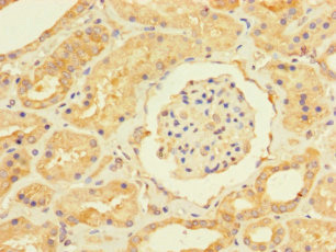 Immunohistochemistry of paraffin-embedded human kidney tissue using CSB-PA025742LA01HU at dilution of 1:100