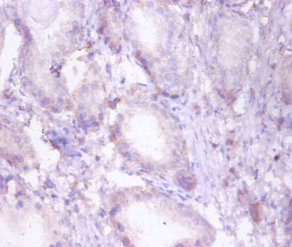 Immunohistochemistry of paraffin-embedded human prostate tissue using CSB-PA03035A0Rb at dilution of 1:50