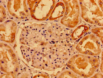 Immunohistochemistry of paraffin-embedded human kidney tissue using CSB-PA619768LA01HU at dilution of 1:100