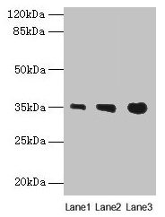 Western blot All lanes: PVRIG antibody at 4microg/ml Lane 1: Mouse liver tissue Lane 2: Mouse kidney tissue Lane 3: Mouse heart tissue Secondary Goat polyclonal to rabbit IgG at 1/10000 dilution Predicted band size: 35 kDa Observed band size: 35 kDa