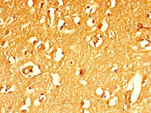 Immunohistochemistry of paraffin-embedded human brain tissue using CSB-PA747224LA01HU at dilution of 1:100