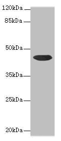 Western blot All lanes: CCDC89 antibody at 1.7microg/ml + Mouse kidney tissue Secondary Goat polyclonal to rabbit IgG at 1/10000 dilution Predicted band size: 44 kDa Observed band size: 44 kDa