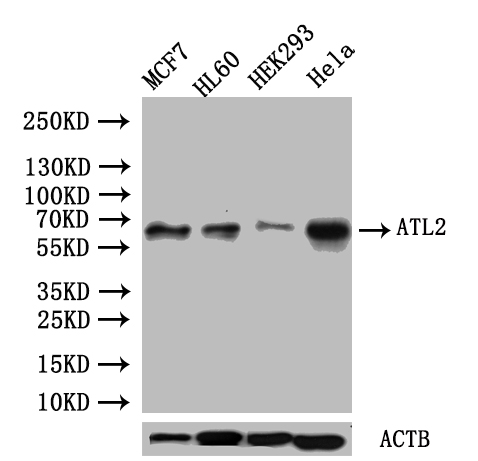 Western blot All lanes: ATL2 antibody at 1microg/ml Lane 1: HepG2 whole cell lysate Lane 2: MCF-7 whole cell lysate Lane 3: HL60 whole cell lysate Lane 4: K562 whole cell lysate Lane 5: U251 whole cell lysate Lane 6: A549 whole cell lysate Lane 7: A431 whole cell lysate Secondary Goat polyclonal to rabbit IgG at 1/10000 dilution Predicted band size: 67, 47, 66, 65 kDa Observed band size: 67 kDa