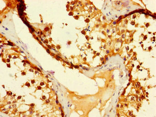 Immunohistochemistry of paraffin-embedded human testis tissue using CSB-PA842675LA01HU at dilution of 1:100