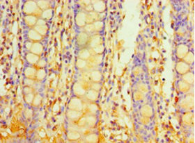 Immunohistochemistry of paraffin-embedded human colon tissue using CSB-PA848395LA01HU at dilution of 1:100