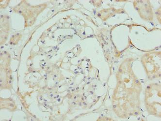 Immunohistochemistry of paraffin-embedded human kidney tissue using CSB-PA850772LA01HU at dilution of 1:100