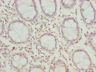 Immunohistochemistry of paraffin-embedded human colon tissue using CSB-PA850772LA01HU at dilution of 1:100