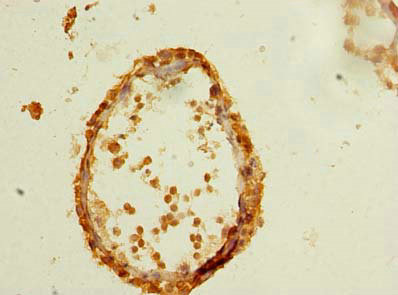 Immunohistochemistry of paraffin-embedded human testis tissue using CSB-PA850915LA01HU at dilution of 1:100