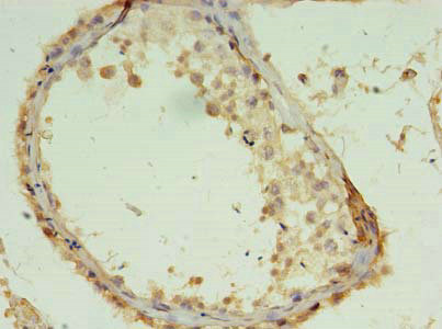 Immunohistochemistry of paraffin-embedded human testis tissue using CSB-PA854026LA01HU at dilution of 1:100