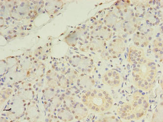 Immunohistochemistry of paraffin-embedded human pancreatic tissue using CSB-PA873612LA01HU at dilution of 1:100