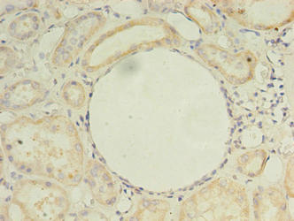 Immunohistochemistry of paraffin-embedded human kidney tissue using CSB-PA873612LA01HU at dilution of 1:100