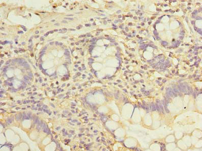 Immunohistochemistry of paraffin-embedded human small intestine tissue using CSB-PA883437LA01HU at dilution of 1:100