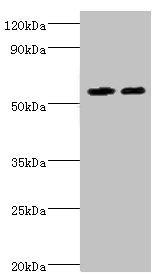 Western blot All lanes: ALDH4A1 antibody at 13microg/ml Lane 1: K562 whole cell lysate Lane 2: 293T whole cell lysate Secondary Goat polyclonal to rabbit IgG at 1/10000 dilution Predicted band size: 62, 56, 57 kDa Observed band size: 62 kDa