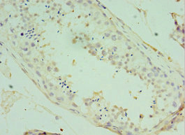 Immunohistochemistry of paraffin-embedded human testis tissue using CSB-PA002279ESR2HU at dilution of 1:100