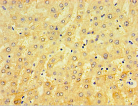 Immunohistochemistry of paraffin-embedded human liver tissue using CSB-PA006004DSR2HU at dilution of 1:100