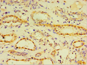 Immunohistochemistry of paraffin-embedded human kidney tissue using CSB-PA006004DSR2HU at dilution of 1:100