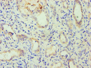 Immunohistochemistry of paraffin-embedded human kidney tissue using CSB-PA008700ESR1HU at dilution of 1:100