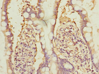 Immunohistochemistry of paraffin-embedded human small intestine tissue using CSB-PA015774ESR2HU at dilution of 1:100