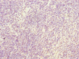 Immunohistochemistry of paraffin-embedded human thymus tissue using CSB-PA015774ESR2HU at dilution of 1:100