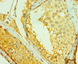 Immunohistochemistry of paraffin-embedded human testis tissue using CSB-PA019252ESR1HU at dilution of 1:100