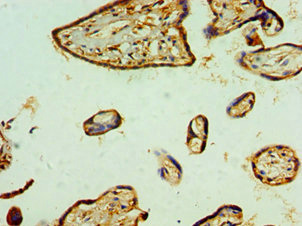 Immunohistochemistry of paraffin-embedded human placenta tissue using CSB-PA019496ESR1HU at dilution of 1:100