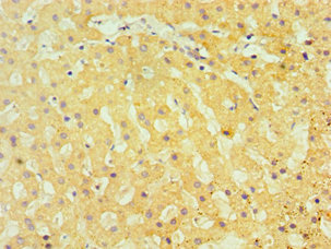 Immunohistochemistry of paraffin-embedded human liver tissue using CSB-PA023243DSR1HU at dilution of 1:100