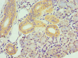 Immunohistochemistry of paraffin-embedded human pancreatic tissue using CSB-PA023243DSR1HU at dilution of 1:100