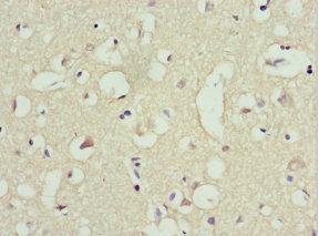 Immunohistochemistry of paraffin-embedded human brain tissue using CSB-PA024450ESR2HU at dilution of 1:100