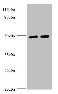 Western blot All lanes: TRIM13 antibody at 1.44microg/ml Lane 1: 293T whole cell lysate Lane 2: Hela whole cell lysate Secondary Goat polyclonal to rabbit IgG at 1/10000 dilution Predicted band size: 47, 20, 48 kDa Observed band size: 47 kDa