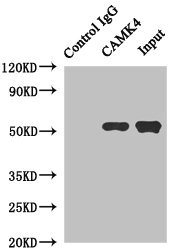 Immunoprecipitating CAMK4 in Jurkat whole cell lysate Lane 1: Rabbit control IgG instead of (1microg) instead of CSB-PA614976ESR2HU in Jurkat whole cell lysate. For western blotting, a HRP-conjugated anti-rabbit IgG, specific to the non-reduced form of IgG was used as the Secondary antibody (1/50000) Lane 2: CSB-PA614976ESR2HU (4microg) + Jurkat whole cell lysate (500microg) Lane 3: Jurkat whole cell lysate (20microg)