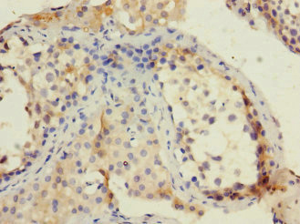 Immunohistochemistry of paraffin-embedded human testis tissue using CSB-PA617924ESR2HU at dilution of 1:100