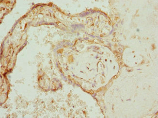 Immunohistochemistry of paraffin-embedded human placenta tissue using CSB-PA621520ESR1HU at dilution of 1:100