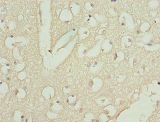 Immunohistochemistry of paraffin-embedded human brain tissue using CSB-PA812863ESR1HU at dilution of 1:100