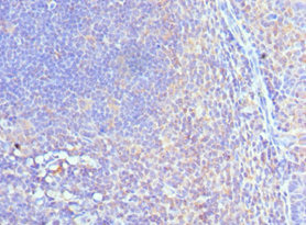 Immunohistochemistry of paraffin-embedded human tonsil tissue using CSB-PA835890ESR1HU at dilution of 1:100