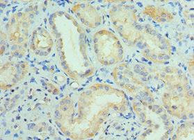 Immunohistochemistry of paraffin-embedded human kidney tissue using CSB-PA835890ESR1HU at dilution of 1:100