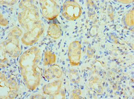 Immunohistochemistry of paraffin-embedded human kidney tissue using CSB-PA835890ESR2HU at dilution of 1:100