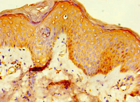 Immunohistochemistry of paraffin-embedded human skin tissue using CSB-PA848838ESR1HU at dilution of 1:100